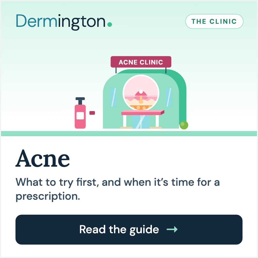 Acne therapy guide at Dermington