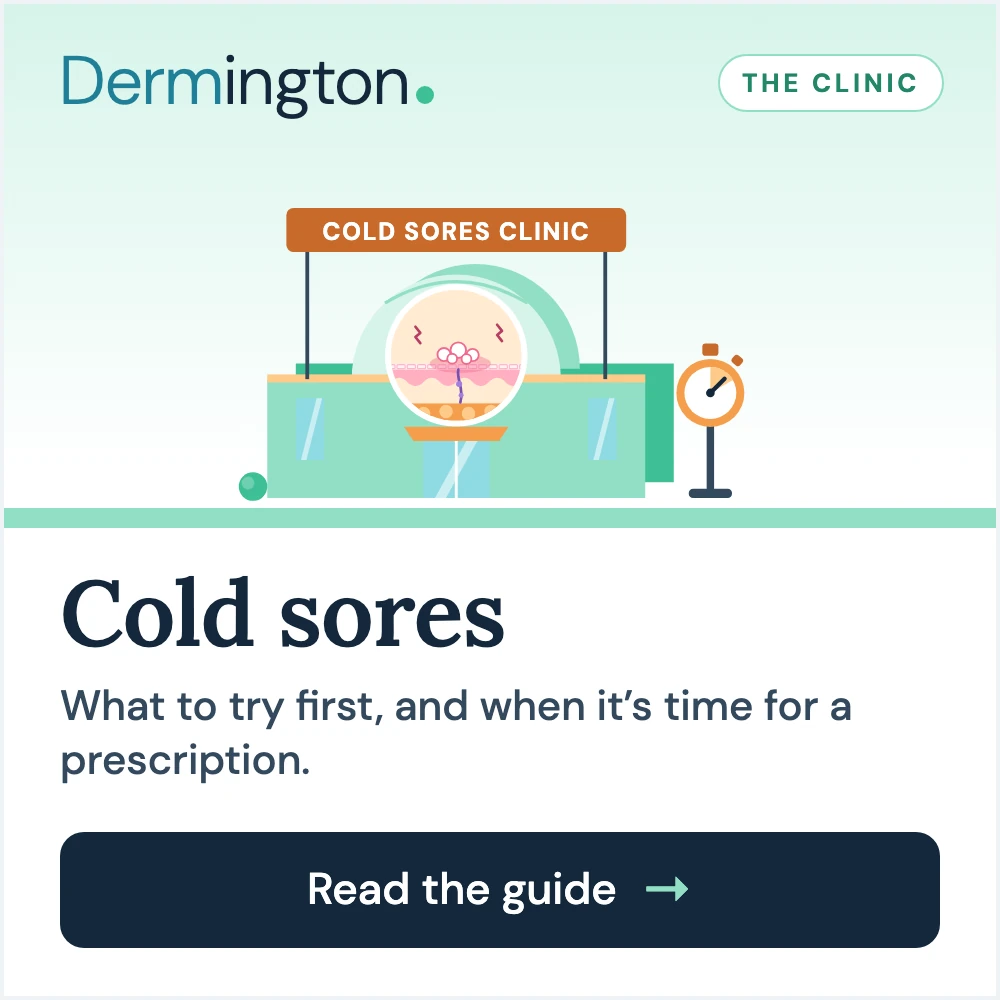 Cold sores therapy guide at Dermington