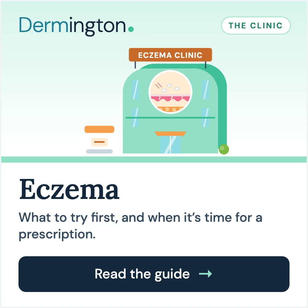 Eczema therapy guide at Dermington
