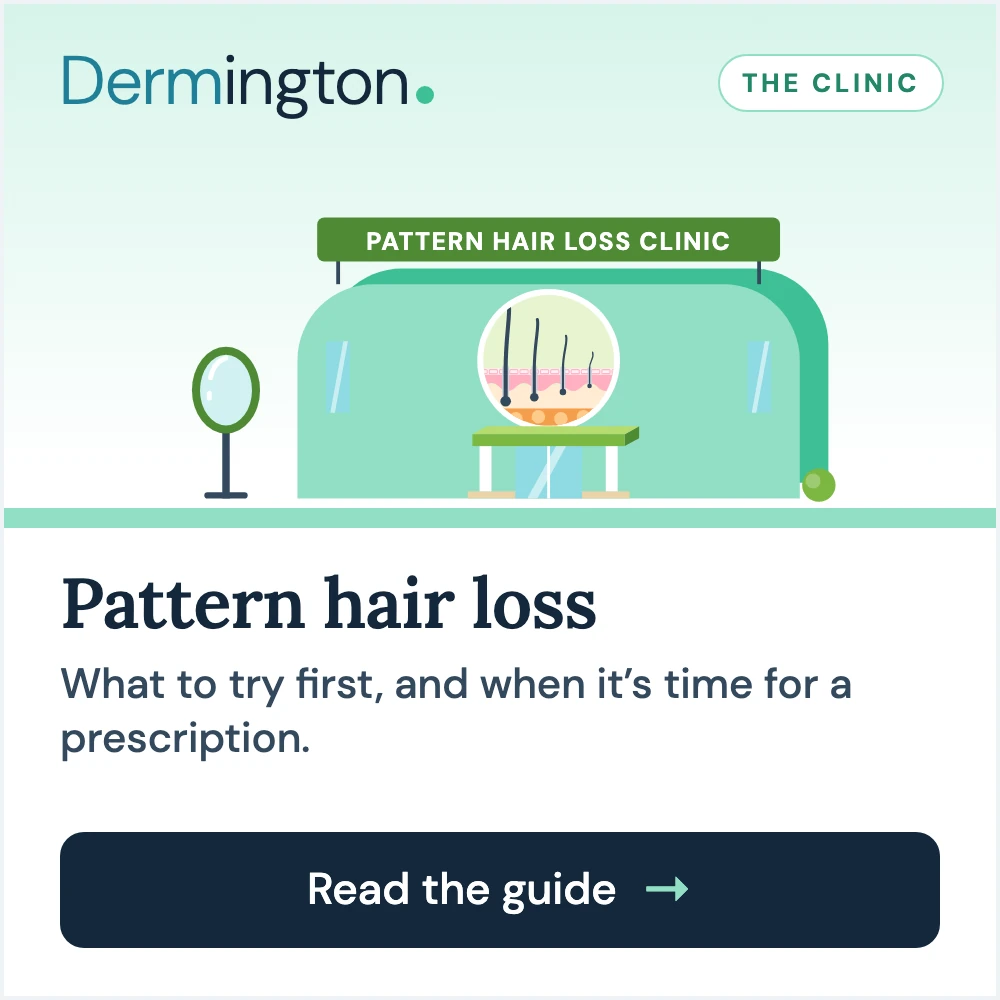Pattern hair loss therapy guide at Dermington