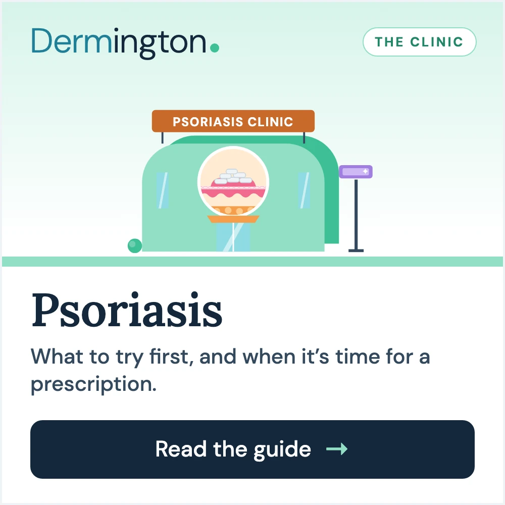 Psoriasis therapy guide at Dermington