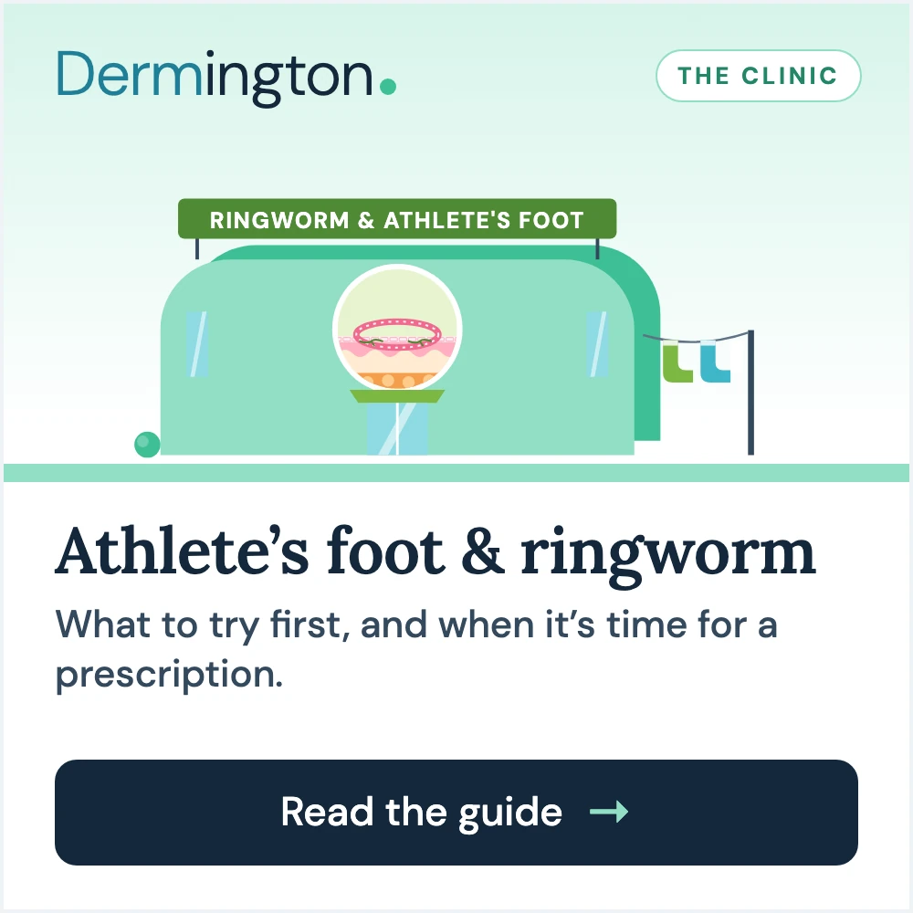 Athlete's foot and ringworm therapy guide at Dermington